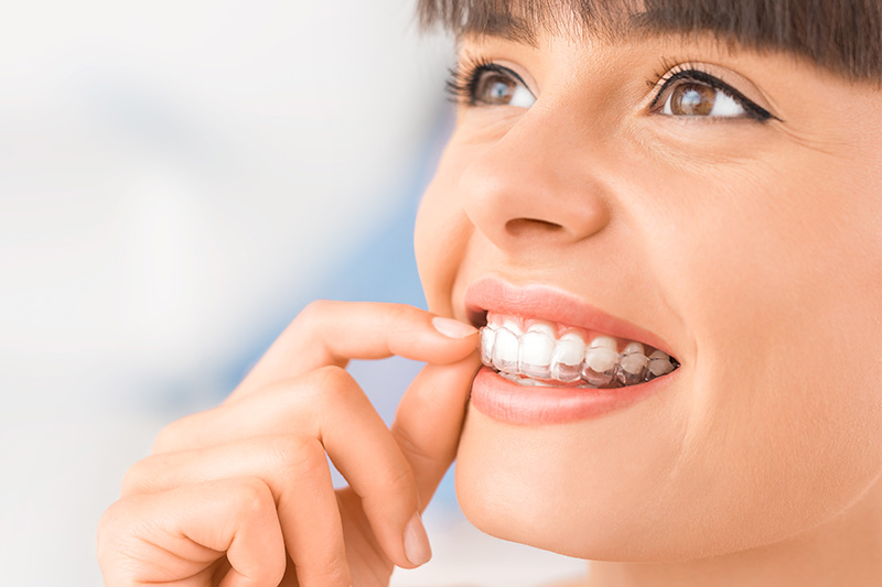 Invisalign in Doylestown & Bucks County